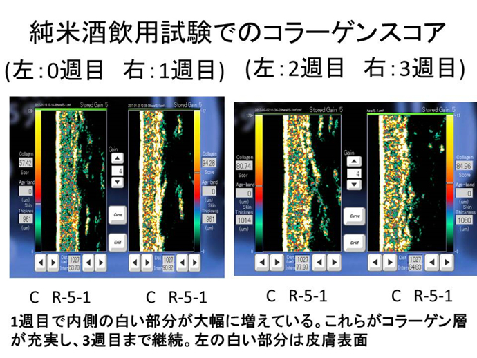 超音波真皮画像装置による「コラーゲンスコア」（真皮中のコラーゲンの密度）