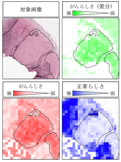 CAMELYON16（＊１）のデータに対して、情報密度法を適用して判断根拠密度を可視化した結果。 緑図と赤図は、がんらしさを表し、青図は正常らしさを表している。情報密度法によって得られるがんを示唆する識別情報量が大きい領域と、CAMELYON16でアノテーション（＊2）された領域はおおむね一致。 この結果から情報量に注目して判断根拠を積み上げることでがん領域を見つけようとするアプローチには一定の妥当性があると考えられる。