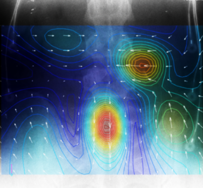 腰部の神経活動